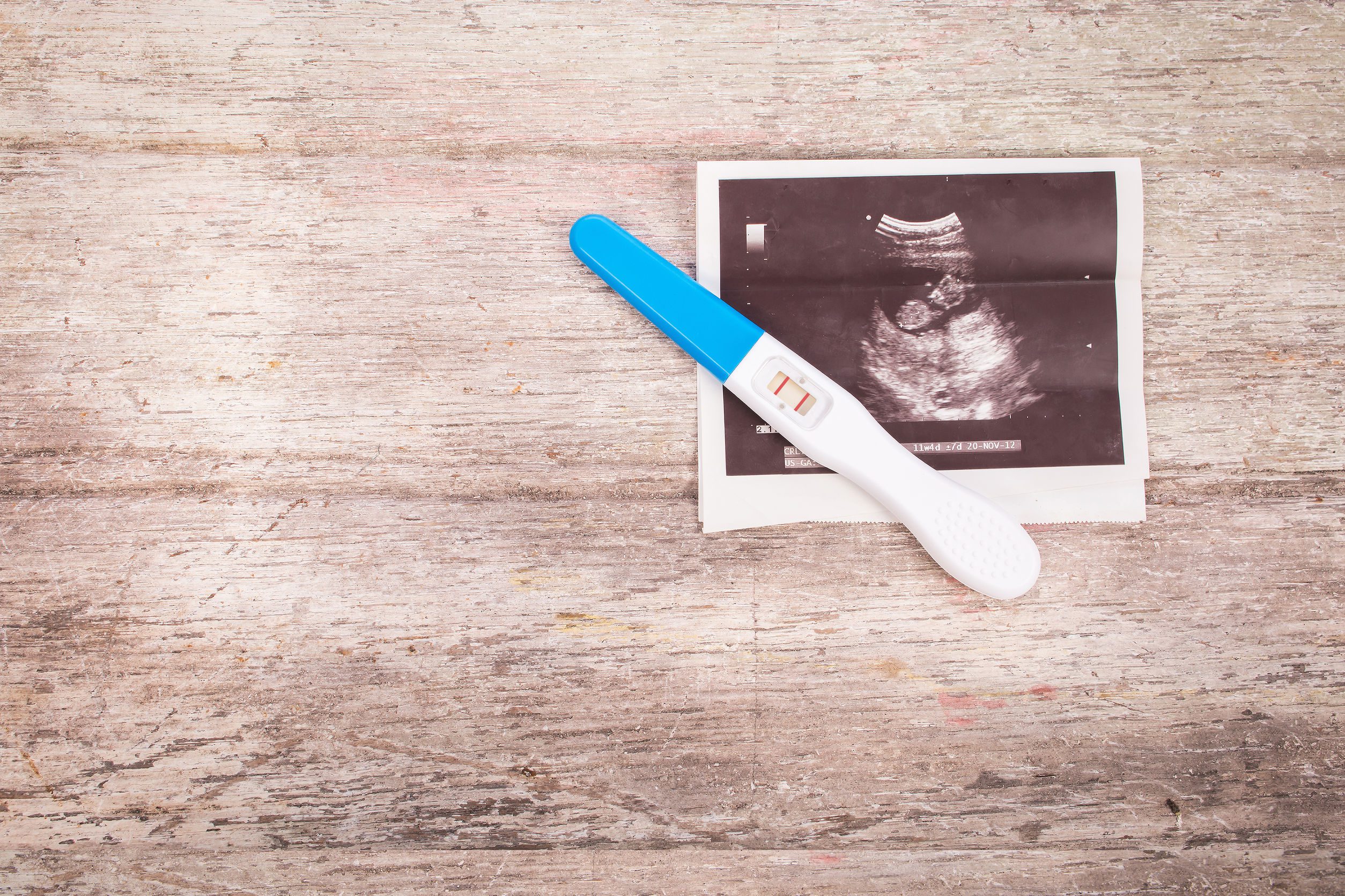 ultrasound with pregnancy test on wooden background